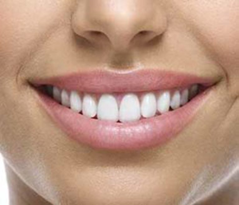 World’s First BPA Composite Free Filling Material Cosmetic Dentistry