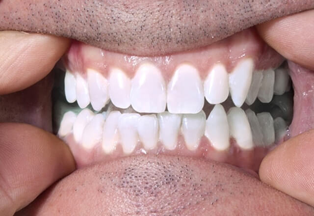http://After%20Image%20Case%201