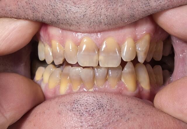 http://Before%20Image%20Case%201