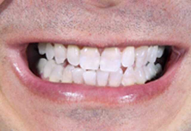 http://After%20Image%20Case%209