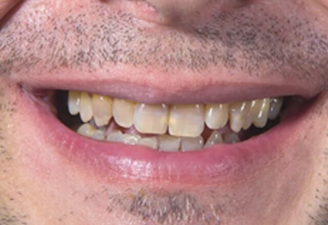 http://Before%20Image%20Case%209
