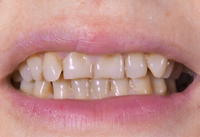 http://Before%20Image%20Case%206