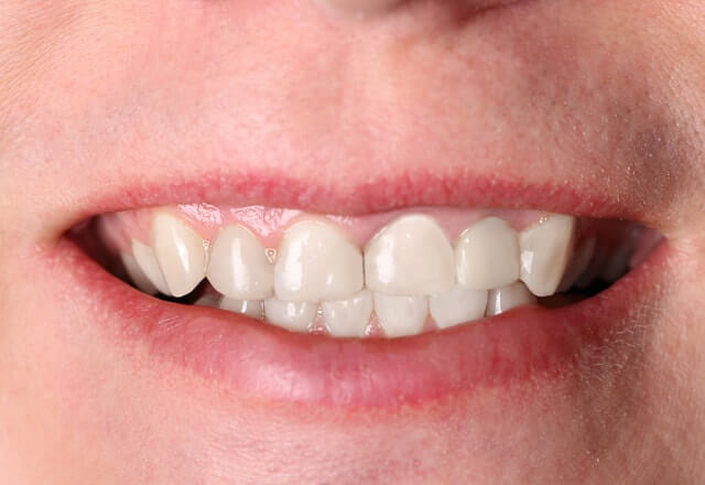http://After%20Image%20Case%207