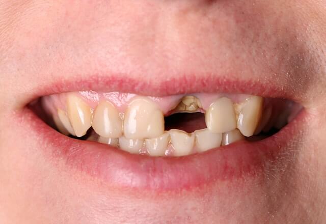 http://Before%20Image%20Case%207