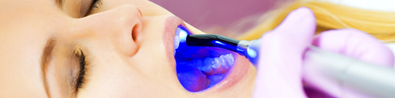 Laser Dentistry, Laser Dentistry