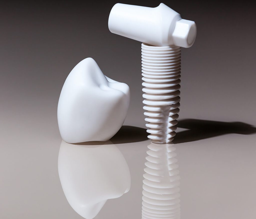 Zirconia Implants Cost Skowhegan Zirconia Implants Benefits
